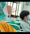 308照光后要擦东西吗